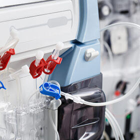 Hemodialysis bloodline tubes connected to hemodialysis machine. Health care, blood purification, kidney failure, transplantation, medical equipment concept.