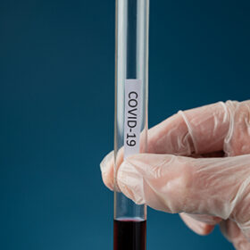 Hand of a doctor wearing protecting glove holding a glass test tube with blood sample and a Covid 19 sign on it.