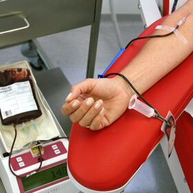 a woman donates blood in a blood lab. blood transfusions can save lives.