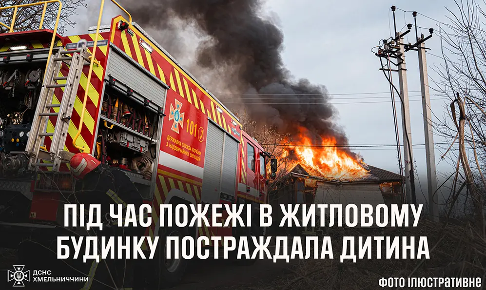 На Хмельниччині під час пожежі постраждала дитина