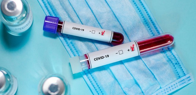 На Хмельниччині зафіксували ще один летальний випадок від COVID-19